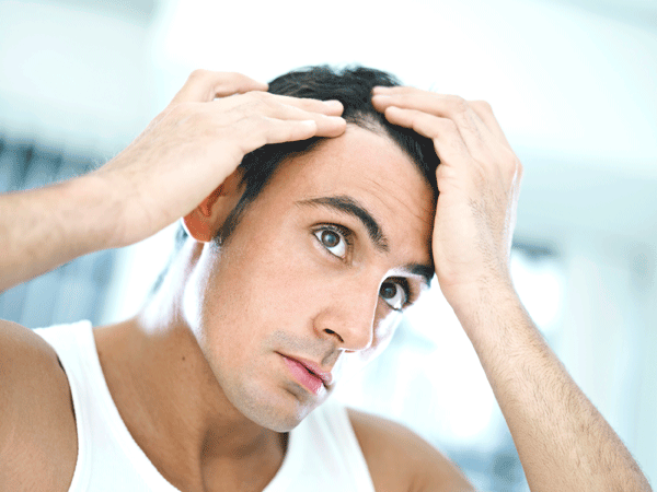 L'alopécie : dommage de se faire des cheveux !