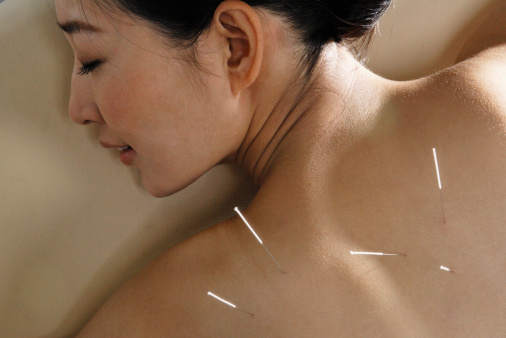 L’acupuncture au secours des états dépressifs